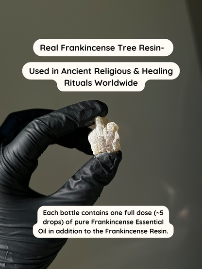 Nature's Botox Balm- Erase Wrinkles + Fine Lines with Castor Oil, Frankincense x2 Infusion, Rosehip & Jojoba Oil